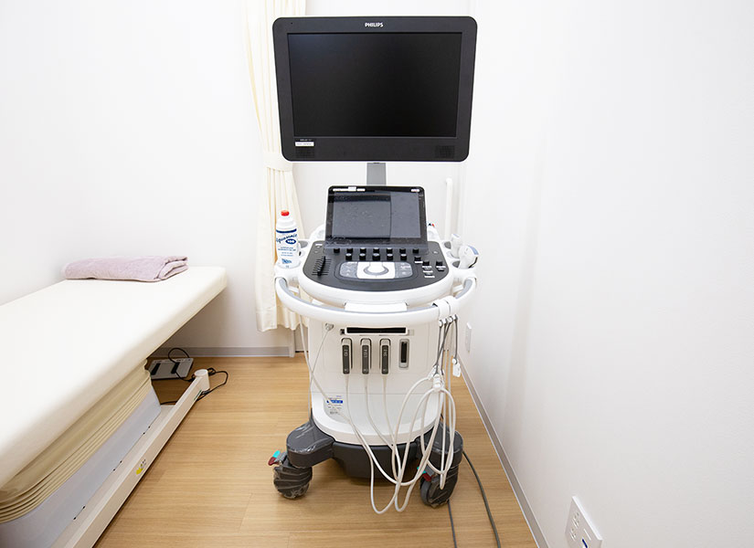 超音波診断装置